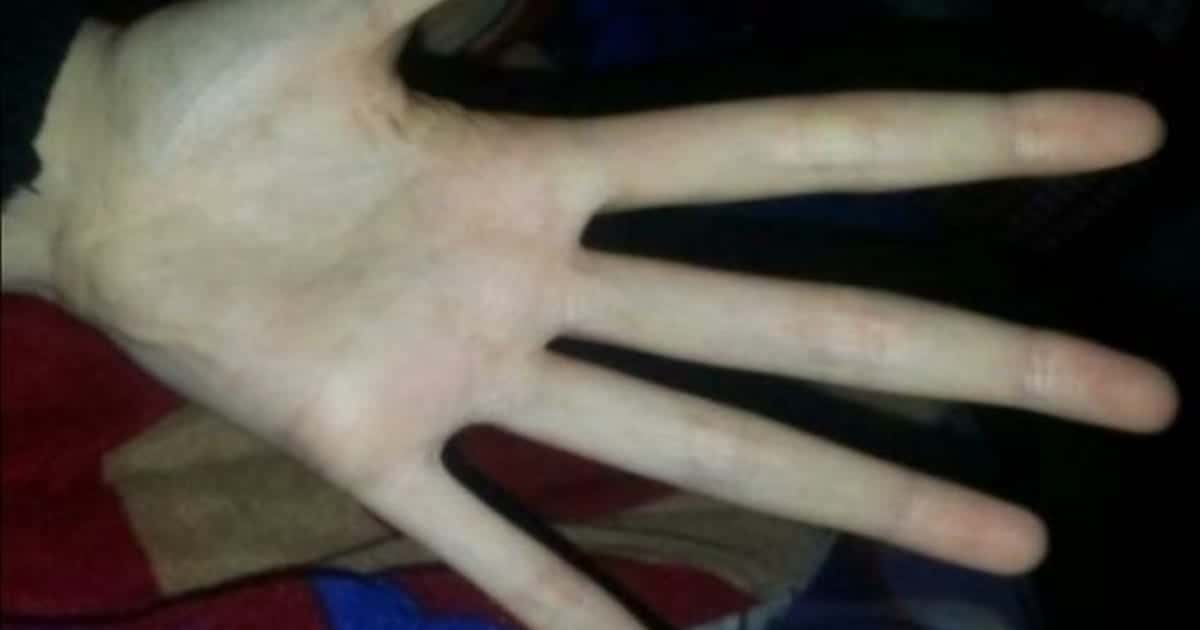 İnsan Vücudunun Şaşırtıcı Halleri: Görmeden İnanması Zor 18 Fotoğraf