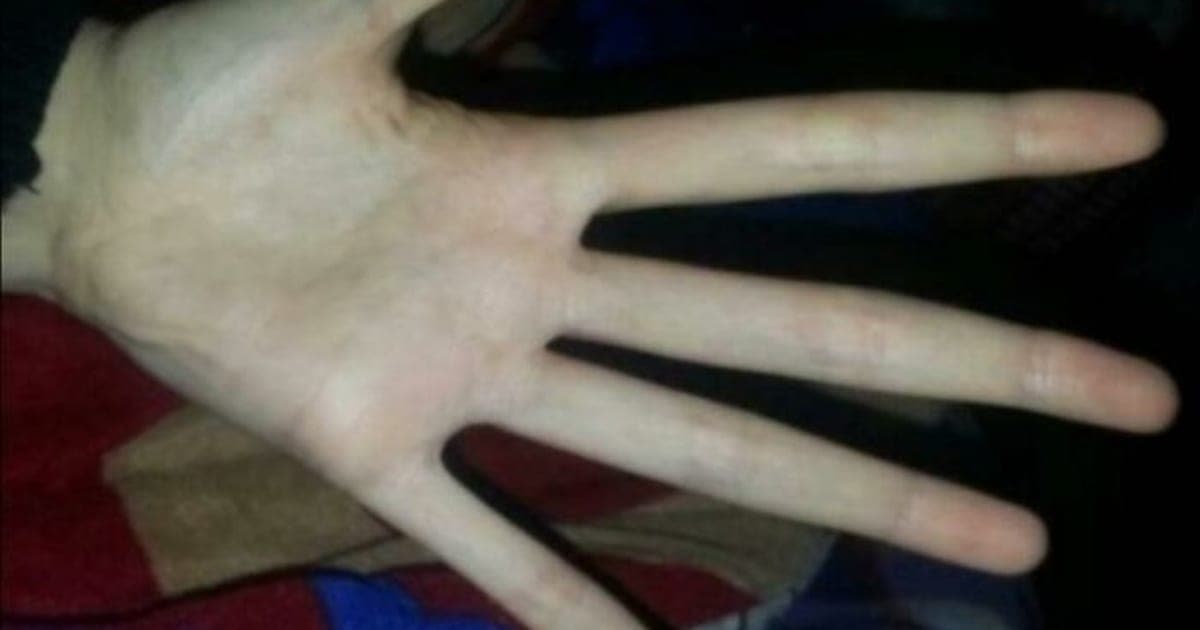 İnsan Vücudunun Şaşırtıcı Halleri: Görmeden İnanması Zor 18 Fotoğraf