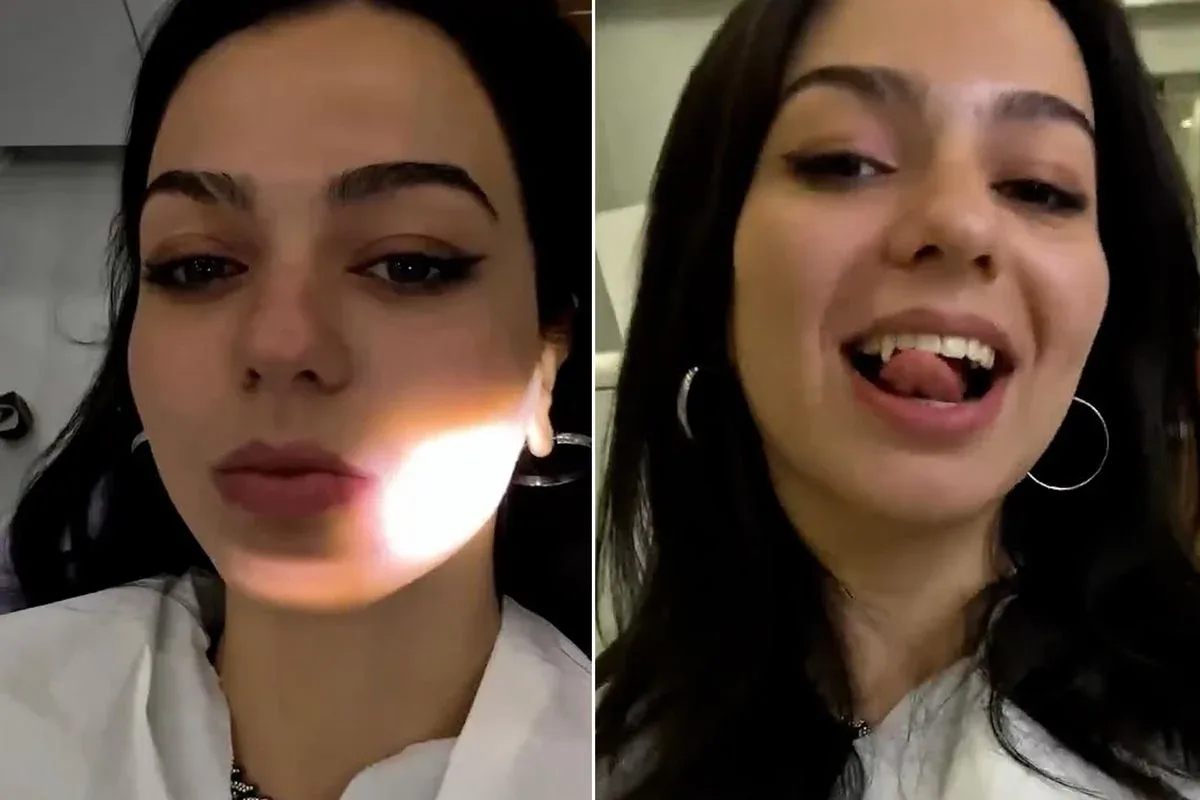 Yeni Estetik Trend: Vampir Dişi Operasyonu ve Detayları